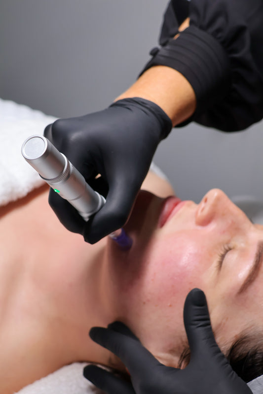 Buy 2 x Collagen Induction Treatment (save $100)